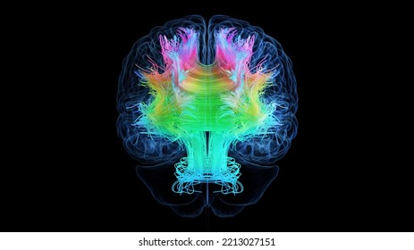 3d Rendered Medical Illustration Of Colored White Brain Matter Fibres