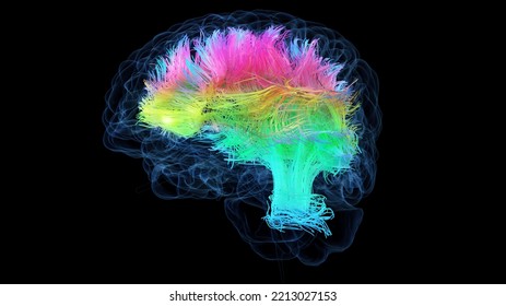 3d Rendered Medical Illustration Of Colored White Brain Matter Fibres