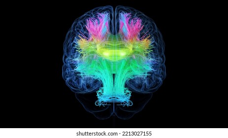 3d Rendered Medical Illustration Of Colored White Brain Matter Fibres