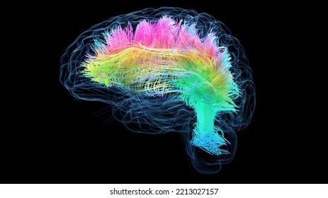 3d Rendered Medical Illustration Of Colored White Brain Matter Fibres