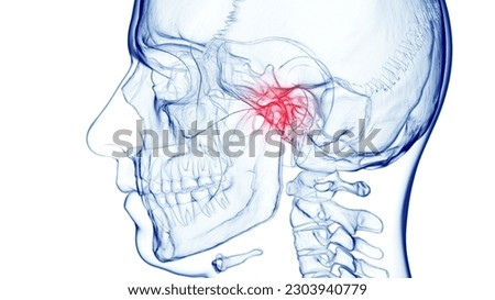 3d rendered medical illustration of male anatomy - skull and cervical spine. jaw pain. plain white background. professional studio lighting. Stock photo © 
