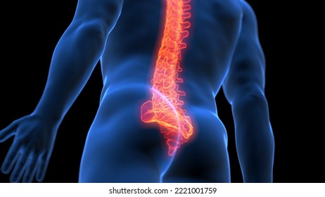 3d Rendered Medical Illustration Of A Painful Lower Spine