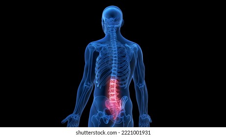 3d Rendered Medical Illustration Of A Painful Lower Spine