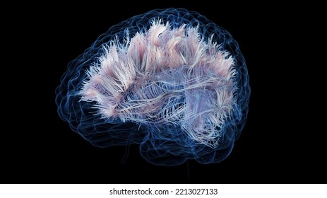 3d Rendered Medical Illustration Of White Brain Matter Fibres