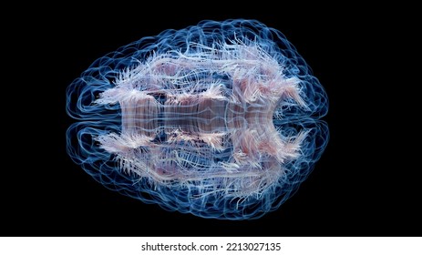 3d Rendered Medical Illustration Of White Brain Matter Fibres