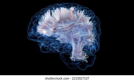 3d Rendered Medical Illustration Of White Brain Matter Fibres