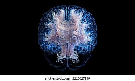 3d Rendered Medical Illustration Of White Brain Matter Fibres