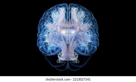 3d Rendered Medical Illustration Of White Brain Matter Fibres