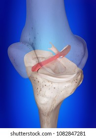 3d rendered, medically accurate illustration of the anterior cruciate ligament