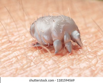 3d Rendered Medically Accurate Illustration Of A Scabies Mite On Human Skin