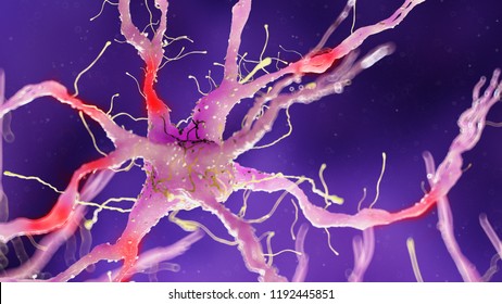 3d Rendered Medically Accurate Illustration Of A Damaged Nerve Cell