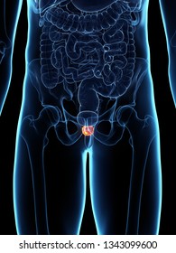 3d Rendered Medically Accurate Illustration Of An Inflamed Prostate