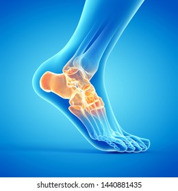 3d rendered medically accurate illustration of a painful ankle