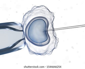 3d Rendered Medically Accurate Illustration Of An Invitro Fertilization