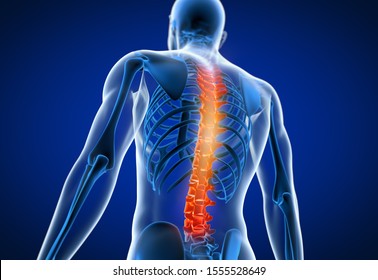 3d rendered medically accurate illustration of a man having a painful back.