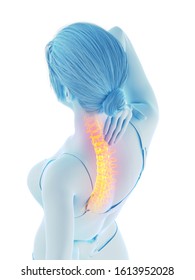 3d rendered medically accurate illustration of a woman having a painful back - Shutterstock ID 1613952028