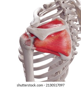 3d Rendered Medically Accurate Illustration Of A Torn Rotator Cuff