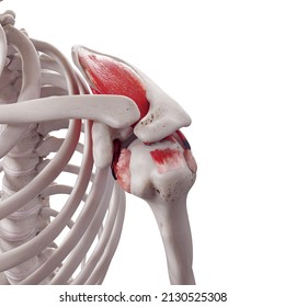 3d rendered medically accurate illustration of a torn rotator cuff