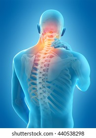 3d Rendered, Medically Accurate 3d Illustration Of Neck Pain