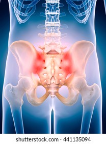 3d rendered, medically accurate 3d illustration of the painful hip