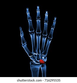 3d Rendered, Medically Accurate Illustration Of The Lunate Bone