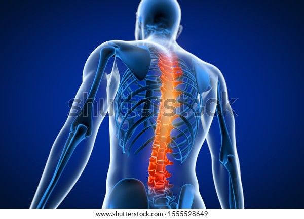 痛みを伴う背中を持つ男性の3dレンダリングで 医学的に正確なイラストが描かれた のイラスト素材
