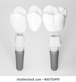 3d rendering dental care
