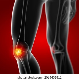 3D Rendering Illustration Of Patella