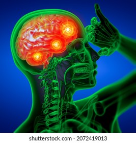 3D Rendering Medical Illustration Of The Brain  - Side View