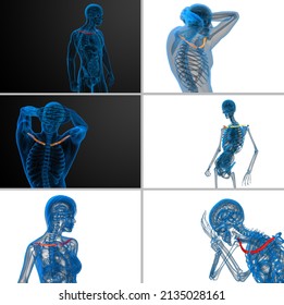 3D Rendering Medical Illustration Of The Clavicle Bone