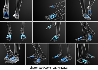 Metatarsal Images, Stock Photos & Vectors | Shutterstock