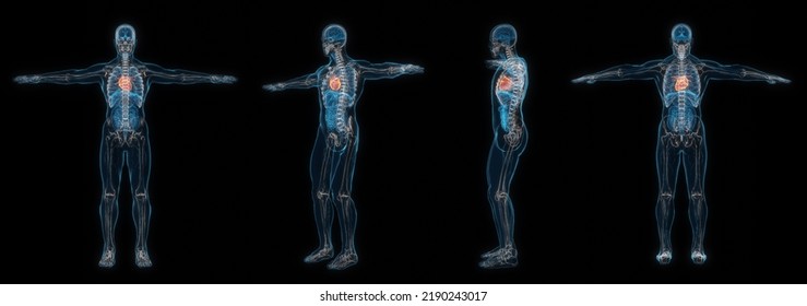 3d Rendering Set Of Human Male Body Heart X-ray Isolated On Black Background.