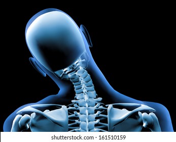 3d X-ray of painful neck