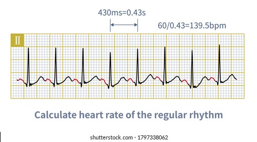 60 Divided By The Cardiac Cycle Is The Heart Rate Per Minute.