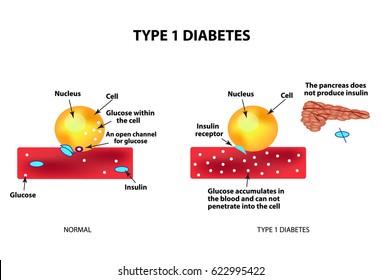 diabetes nacional mes diabetes tipo 1