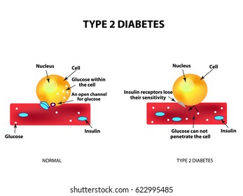 fotos de mes de diabetes americana bebé