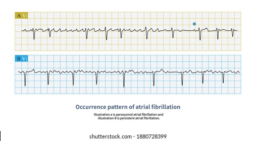 3 Long term ekg Images, Stock Photos & Vectors | Shutterstock