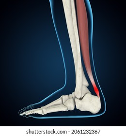 Achilles Tendinitis 3D Rendering, Foot Anatomy, Heel Pain, Foot Pain