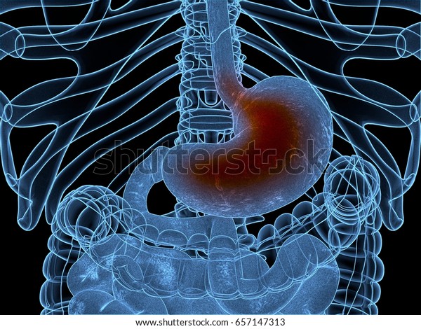酸の逆流 Gerd 胃食道逆流症 胃と消化器 人間の解剖学 3dイラスト のイラスト素材