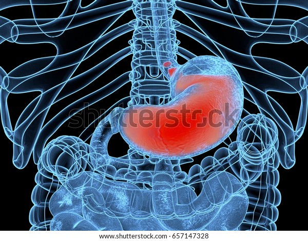 酸の逆流 Gerd 胃食道逆流症 胃と消化器 人間の解剖学 3dイラスト のイラスト素材