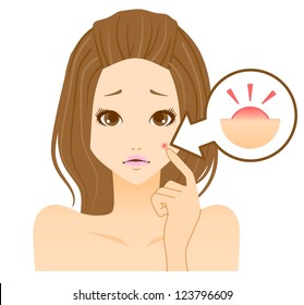Acne women