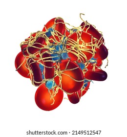 Activated Platelets (thrombocytes) Forming A Blood Clot (thrombus) Covered By Fibrin Mesh. The Platelets Are The Blood Cells Repairing Blood Vessel Damage. Blood Clot Isolated On White 3d Illustration