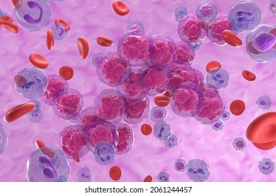 Acute Lymphoblastic Leukemia (ALL) Cancer Cell Clusters In The Blood Flow - Isometric View 3d Illustration