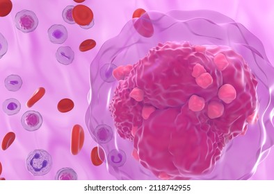 Acute Lymphoblastic Leukemia (ALL) Cancer Cell In Blood Flow - Super Closeup View 3d Illustration