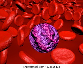 Acute Myeloid Leukemia A 3d-Render