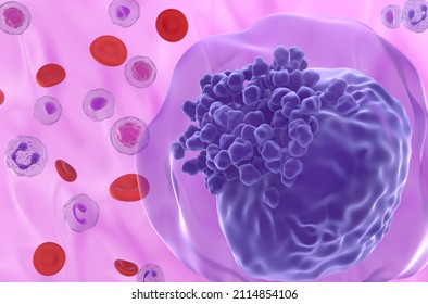 Acute Myeloid Leukemia (AML) Cell In Blood Flow - Super Closeup View 3d Illustration