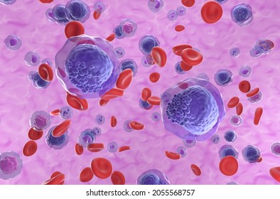 Acute Myeloid Leukemia (AML) Cells In Blood Flow - Isometric View 3d Illustration