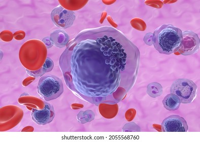 Acute Myeloid Leukemia (AML) Cells In Blood Flow - Closeup View 3d Illustration