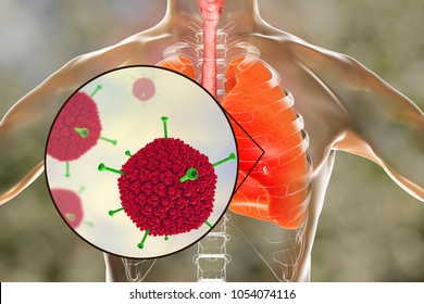 107 Adeno virus Images, Stock Photos & Vectors | Shutterstock