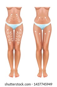 All About Legs. Problems:pain In Legs, Varicose Veins, Degenerative Joint Disease - And Treatment: Medical Massage, Compression Garment, Balms